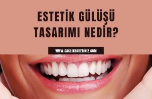 Estetik Gülüşü Tasarımı Nedir?