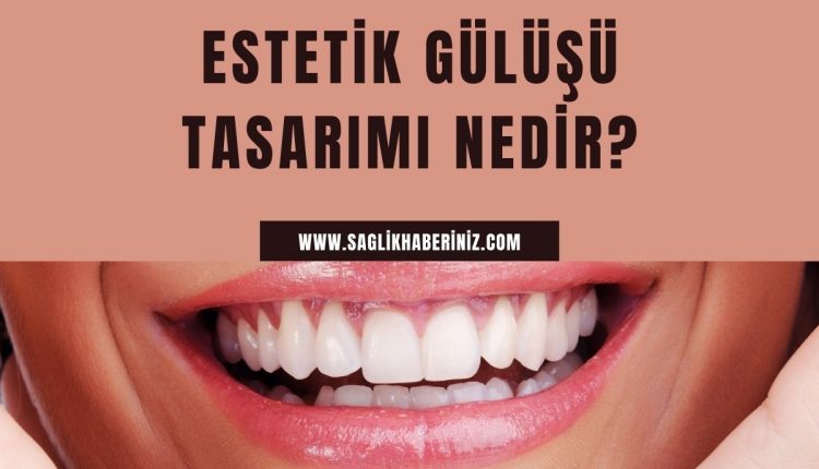 Estetik Gülüşü Tasarımı Nedir?